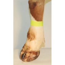 Ankle Straps Velcro Yellow (5/PKG)